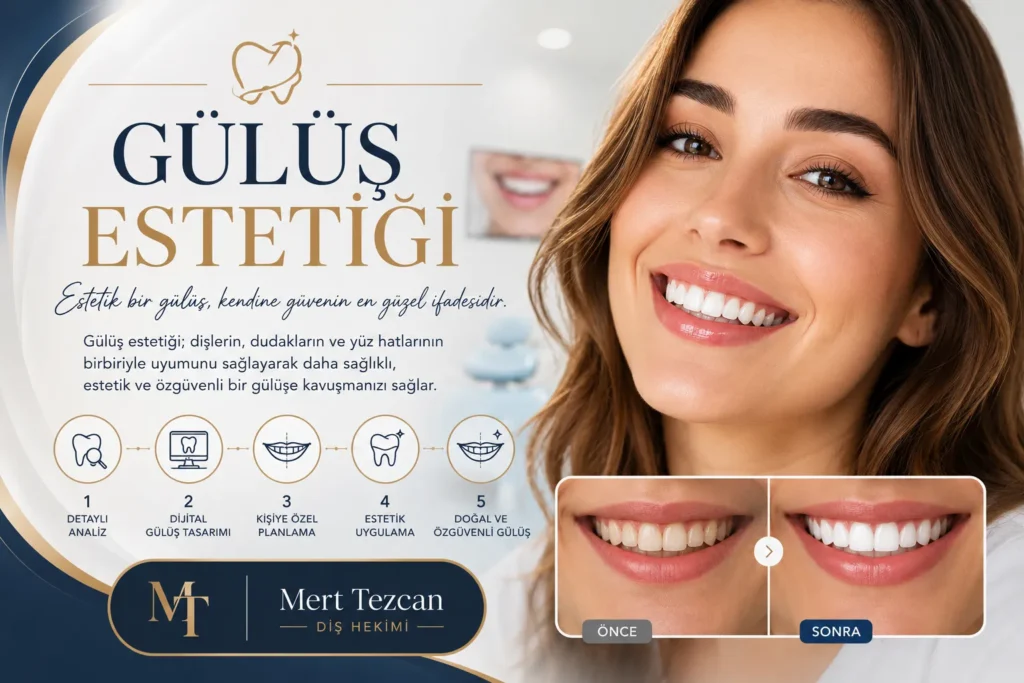 Gülüş Estetiği